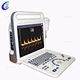 Color Doppler ultrasound
